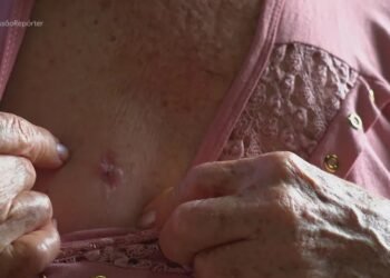 Após morte de marido agressor, idosa relata que passou a apanhar do filho: ‘O mundo caiu pra mim’