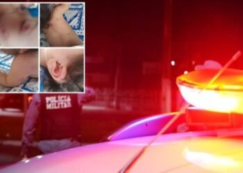 Pais denunciam creche do CPA após filha voltar com 17 mordidas