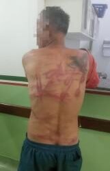 Homem é chicoteado com fio de luz após ameaçar ex-esposa de morte