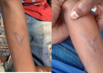 Criança indígena é marcada com ferro quente por pecuarista