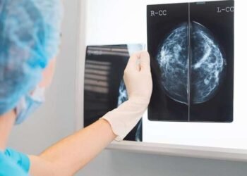 Mato Grosso Saúde amplia isenção de coparticipação em mamografias para homens e mulheres em outubro