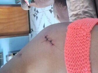 Mulher sobrevive a tentativa de feminicídio em Alta Floresta