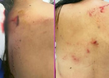 Mulher é esfaqueada 15 vezes depois de ser atraída para emboscada por ex