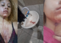 Jovem denuncia agressão de PMs dentro de casa em Cuiabá