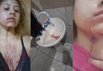 Jovem denuncia agressão de PMs dentro de casa em Cuiabá
